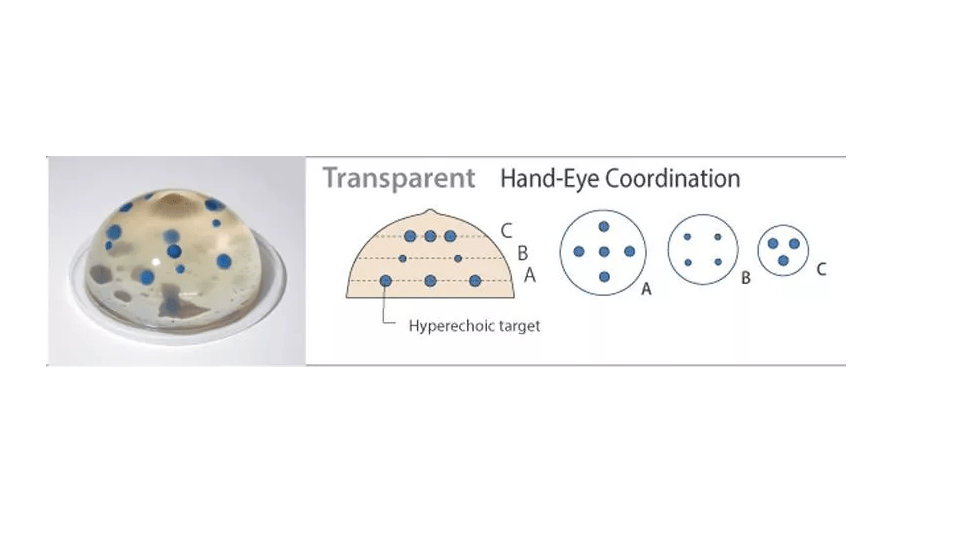 Ultraschallgestütztes Brustbiopsie - Phantom (Set mit zwei Basisphantomen) - Erler - Zimmer